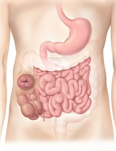 Colostomia ascendente