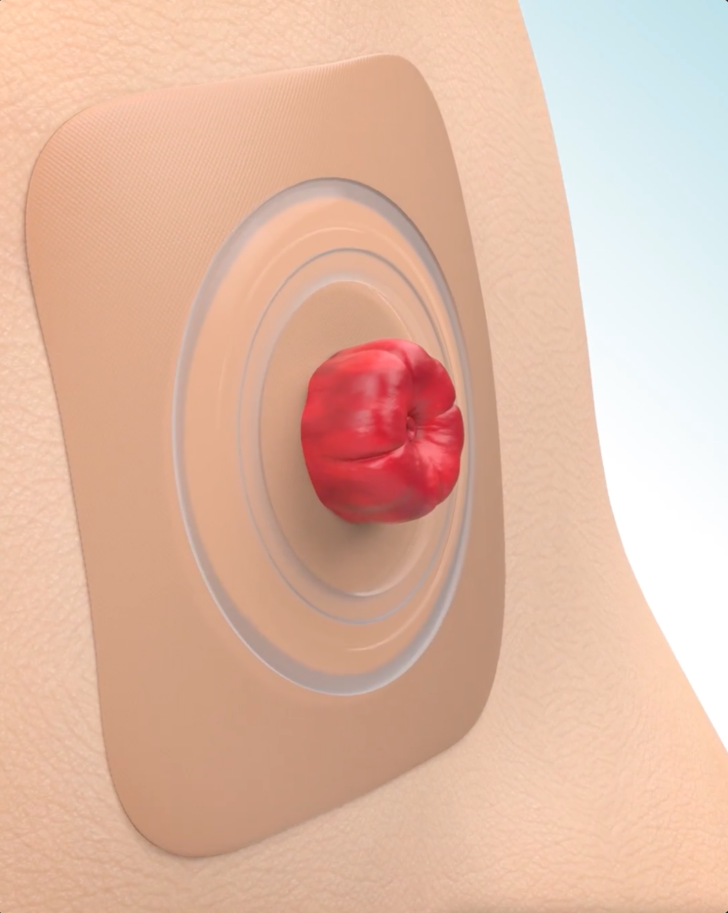 Video Convatec-liimojen toiminnasta