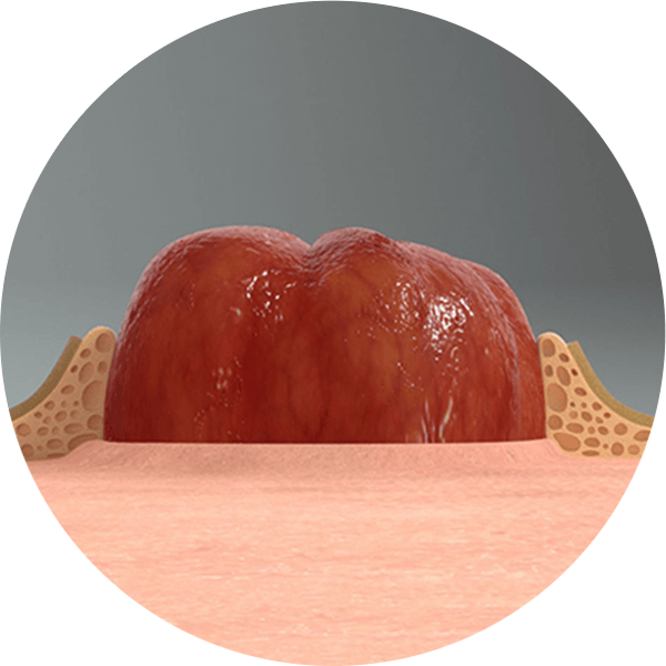 um close-up do sistema LEAK-LOCK™